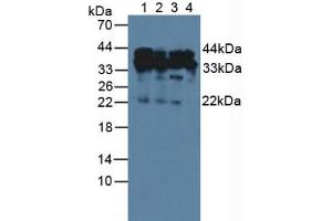 Western blot analysis of (1) Human HeLa cells, (2) Human A549 Cells, (3) Human Jurkat Cells and (4) Human 293T Cells. (HDGF anticorps  (AA 10-240))