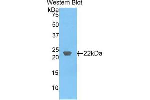 Western blot analysis of the recombinant protein. (CLEC3B anticorps  (AA 22-202))
