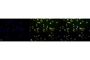 Immunocytochemistry/Immunofluorescence analysis using Rabbit Anti-Rab5 Polyclonal Antibody (ABIN361845 and ABIN361846).