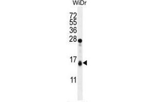TOMM20L Antibody (N-term) western blot analysis in WiDr cell line lysates (35 µg/lane). (TOMM20L anticorps  (N-Term))