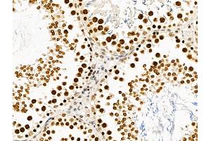 ABIN6265482 and ABIN6269020 at 1/100 staining Rat testis tissue by IHC-P. (TBP anticorps  (N-Term))