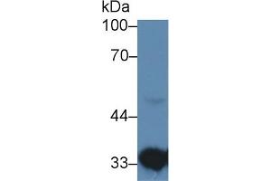Detection of HADH in Human Liver lysate using Polyclonal Antibody to Hydroxyacyl Coenzyme A Dehydrogenase (HADH) (HADH anticorps  (AA 1-236))