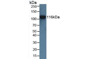 Detection of MUSK in Human Jurkat Cells using Polyclonal Antibody to Muscle, Skeletal, Receptor Tyrosine Kinase (MUSK) (MUSK anticorps  (AA 517-777))