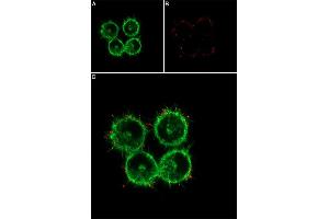 Live cell imaging of recombinant human GDNF-Biotin protein in live intact human SH-SY5Y cells. (GDNF Protein (Biotin))