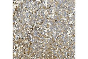 IHC analysis of ASAH1 using anti-ASAH1 antibody (ABIN7602206). (ASAH1 anticorps  (AA 63-393))