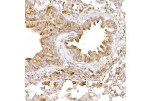 Immunohistochemistry of paraffin-embedded human esophagus using B Rabbit pAb (ABIN6131247, ABIN6137447, ABIN6137448 and ABIN6222194) at dilution of 1:50 (40x lens).