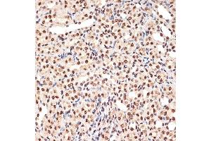 Immunohistochemistry of paraffin-embedded mouse kidney using B Rabbit mAb (ABIN7265377) at dilution of 1:100 (40x lens).