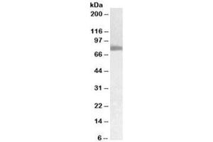Western blot testing of human pancreas cancer lysate with TGM2 antibody at 0. (Transglutaminase 2 anticorps)