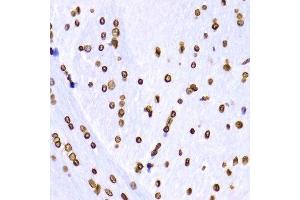 Immunohistochemistry of paraffin-embedded Rat brain using TriMethyl-Histone H3-K9 antibody. (Histone 3 anticorps  (H3K9me3))