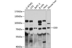 Western blot analysis of extracts of various cell lines, using OS9 antibody (ABIN6131415, ABIN6145063, ABIN6145064 and ABIN6215868) at 1:3000 dilution. (OS9 anticorps  (AA 353-612))