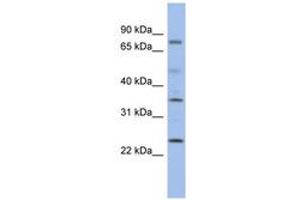 Image no. 1 for anti-Protein Phosphatase, Mg2+/Mn2+ Dependent, 1K (PPM1K) (C-Term) antibody (ABIN6743697) (PPM1K anticorps  (C-Term))