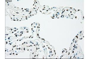 Image no. 3 for anti-Checkpoint Kinase 2 (CHEK2) antibody (ABIN1497496)