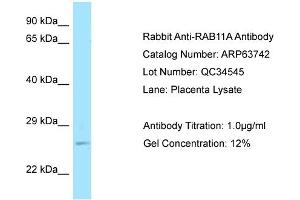 Western Blotting (WB) image for anti-RAB11A, Member RAS Oncogene Family (RAB11A) (C-Term) antibody (ABIN2789607) (RAB11A anticorps  (C-Term))