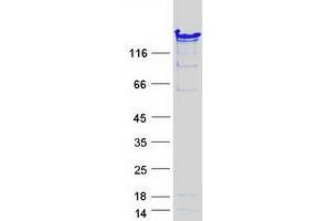 Validation with Western Blot