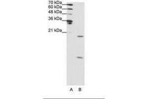 Image no. 2 for anti-Small Nuclear Ribonucleoprotein Polypeptide F (SNRPF) (N-Term) antibody (ABIN202012) (SNRPF anticorps  (N-Term))