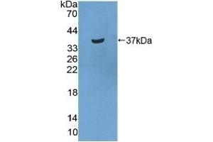 Detection of Recombinant STATH, Human using Polyclonal Antibody to Statherin (STATH) (STATH anticorps  (AA 1-62))