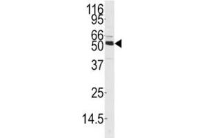 Western blot analysis of CAMKK1 antibody and mouse thymus tissue lysate.