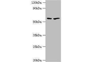 Western blot All lanes: 5-aminolevulinate synthase, erythroid-specific, mitochondrial antibody at 7 μg/mL Lane 1: 293T whole cell lysate Lane 2: Mouse brain tissue Secondary Goat polyclonal to rabbit IgG at 1/10000 dilution Predicted band size: 65, 61, 50, 64 kDa Observed band size: 65 kDa (ALAS2 anticorps  (AA 50-320))