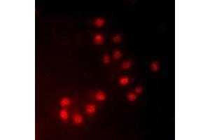Immunofluorescent analysis of MKI67IP (pT234) staining in HeLa cells.