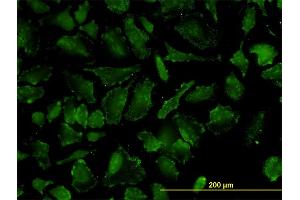 Immunofluorescence of monoclonal antibody to OXSR1 on HeLa cell.
