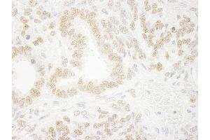 Immunohistochemistry (IHC) image for anti-Zinc Finger, MYM-Type 2 (ZMYM2) (AA 1327-1377) antibody (ABIN7448880)
