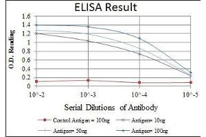Red: Control Antigen (100 ng), Purple: Antigen (10 ng), Green: Antigen (50 ng), Blue: Antigen (100 ng), (CDK1 anticorps)