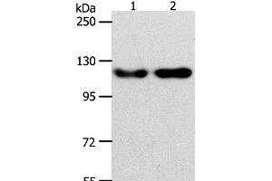 Western Blot analysis of Hela and Jurkat cell using ABL2 Polyclonal Antibody at dilution of 1:400 (ABL2 anticorps)