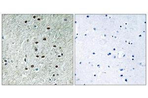 Immunohistochemistry analysis of paraffin-embedded human brain tissue using REXO1 antibody. (REXO1 anticorps  (Internal Region))