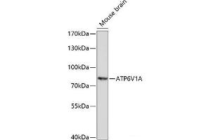 Western blot analysis of extracts of Mouse brain using ATP6V1A Polyclonal Antibody at dilution of 1:1000. (ATP6V1A anticorps)