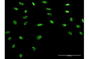 Immunofluorescence of purified MaxPab antibody to APEX1 on HeLa cell.