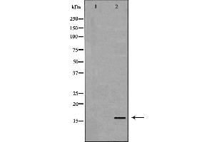Western blot analysis of Blood  lysate using TTR antibody. (TTR anticorps  (C-Term))