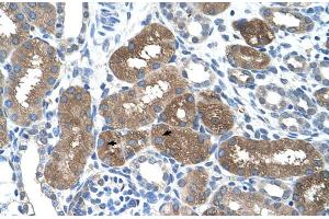 Rabbit Anti-SOCS1 Antibody  Paraffin Embedded Tissue: Human Kidney Cellular Data: Epithelial cells of renal tubule Antibody Concentration: 4.