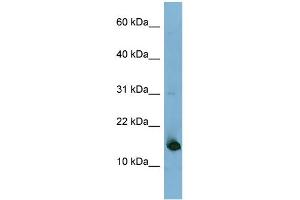 WB Suggested Anti-MED31 Antibody Titration: 0. (MED31 anticorps  (N-Term))