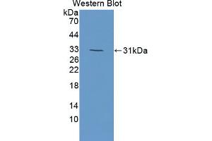 Western blot analysis of the recombinant protein. (DOK7 anticorps  (AA 63-320))