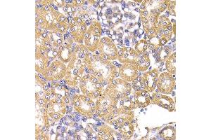 Immunohistochemistry of paraffin-embedded rat kidney using LAP3 antibody at dilution of 1:100 (x400 lens). (LAP3 anticorps)