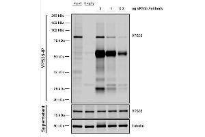 Immunoprecipitation analysis using Mouse Anti-VPS35 Monoclonal Antibody, Clone 11H10 (ABIN6933004).