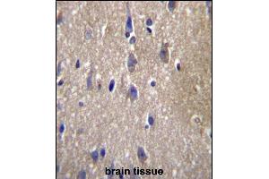 CPN2 Antibody (N-term) (ABIN657122 and ABIN2846266) immunohistochemistry analysis in formalin fixed and paraffin embedded human brain tissue followed by peroxidase conjugation of the secondary antibody and DAB staining. (CPN2 anticorps  (N-Term))