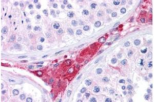 Human Testis: Formalin-Fixed, Paraffin-Embedded (FFPE)