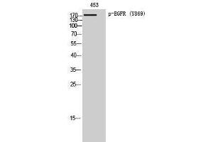 Western Blotting (WB) image for anti-Epidermal Growth Factor Receptor (EGFR) (pTyr869) antibody (ABIN3179433) (EGFR anticorps  (pTyr869))