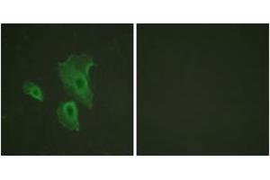 Immunofluorescence analysis of HeLa cells, using BCL-2 (Phospho-Thr69) Antibody.
