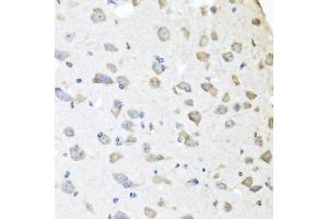 Immunohistochemistry of paraffin-embedded mouse brain using APCS antibody (ABIN5971040) at dilution of 1/100 (40x lens). (APCS anticorps)