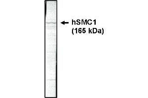 Western blotting using SMC1 antibody on HeLa cell lysate at 1 µg/ml. (SMC1A anticorps  (AA 402-894))