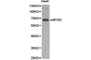 Western Blotting (WB) image for anti-Myocilin (MYOC) antibody (ABIN1873807)