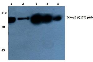 Western blot(WB) analysis of IKKα/β antibody at 1/500 dilution (IKK alpha anticorps)