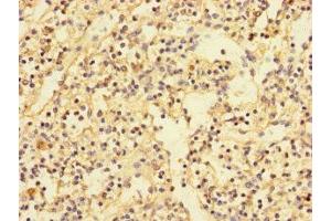 Immunohistochemistry of paraffin-embedded human spleen tissue using ABIN7169137 at dilution of 1:100 (PDIK1L anticorps  (AA 1-341))