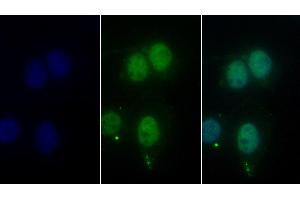 Detection of HDAC1 in Human Hela cell using Monoclonal Antibody to Histone Deacetylase 1 (HDAC1)