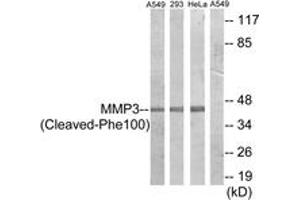 Western blot analysis of extracts from A549/293/HeLa cells, treated with etoposide 25uM 24h, using MMP3 (Cleaved-Phe100) Antibody.