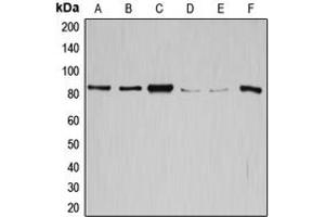 Western blot analysis of GYS1 expression in SW626 (A), SKOV3 (B), HeLa (C), K562 (D), HepG2 (E), mouse liver (F) whole cell lysates. (Glycogen Synthase 1 anticorps  (C-Term))