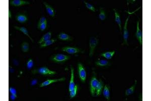 Immunofluorescent analysis of Hela cells using ABIN7168600 at dilution of 1:100 and Alexa Fluor 488-congugated AffiniPure Goat Anti-Rabbit IgG(H+L)