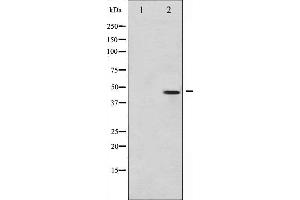 Western blot analysis of c-Jun phosphorylation expression in UV treated HeLa whole cell lysates,The lane on the left is treated with the antigen-specific peptide.